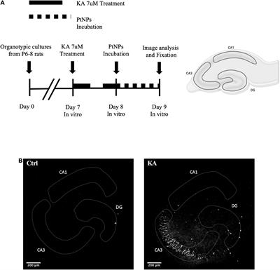 Biocompatibility of Platinum Nanoparticles in Brain ex vivo Models in Physiological and Pathological Conditions